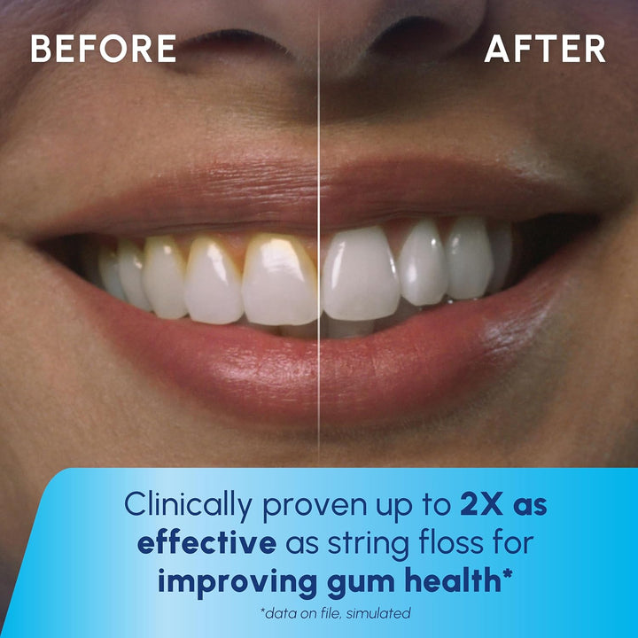 Cordless Pearl Rechargeable Portable Water Flosser for Teeth, Gums, Braces Care and Travel with 4 Flossing Tips - ADA Accepted, WF-13 White, Packaging May Vary