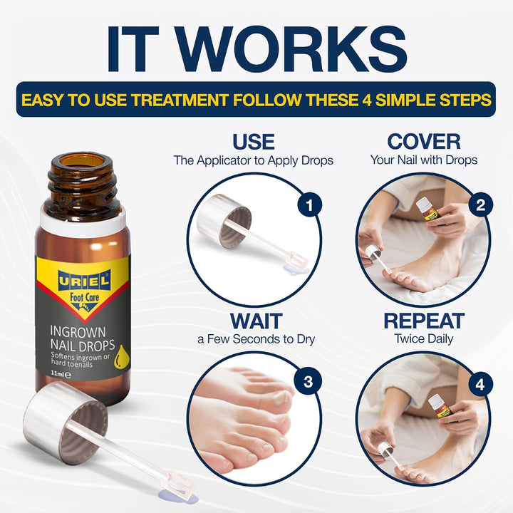 UPGRADED Ingrown Toenail Treatment, Ingrown Toenail Removal Kit, Ingrown Toenail Corrector, Ingrown Nail Kit Ingrown Toenail Tool 11 Ml