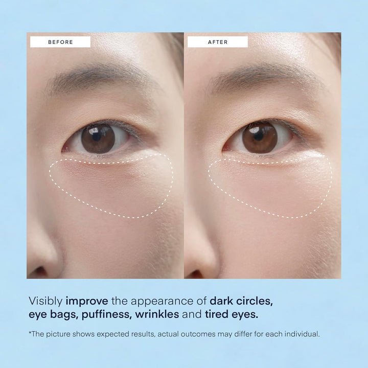 under Eye Patches for Dark Circles - 60 Korean Hydrogel Masks for Puffiness, Bags with Caffeine, Hyaluronic Acid, Niacinamide - Undereye Brightening, Hydrating, Anti-Wrinkle & Cooling