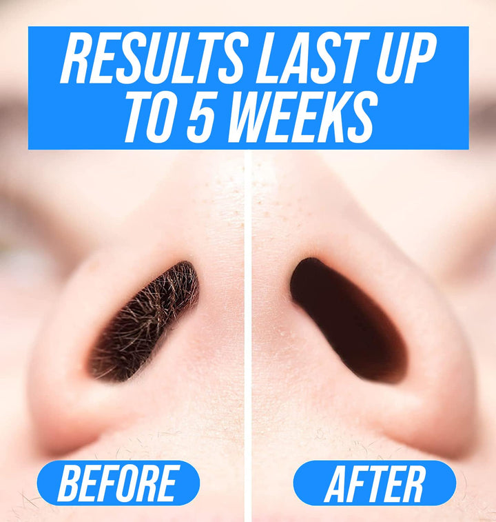 Nose Wax Kit | 100 G Wax, 24 Applicators | Hair Removal Kit for Men and Women | Includes Balm Wipes and Mustache Guards | Lasts up to 5 Weeks