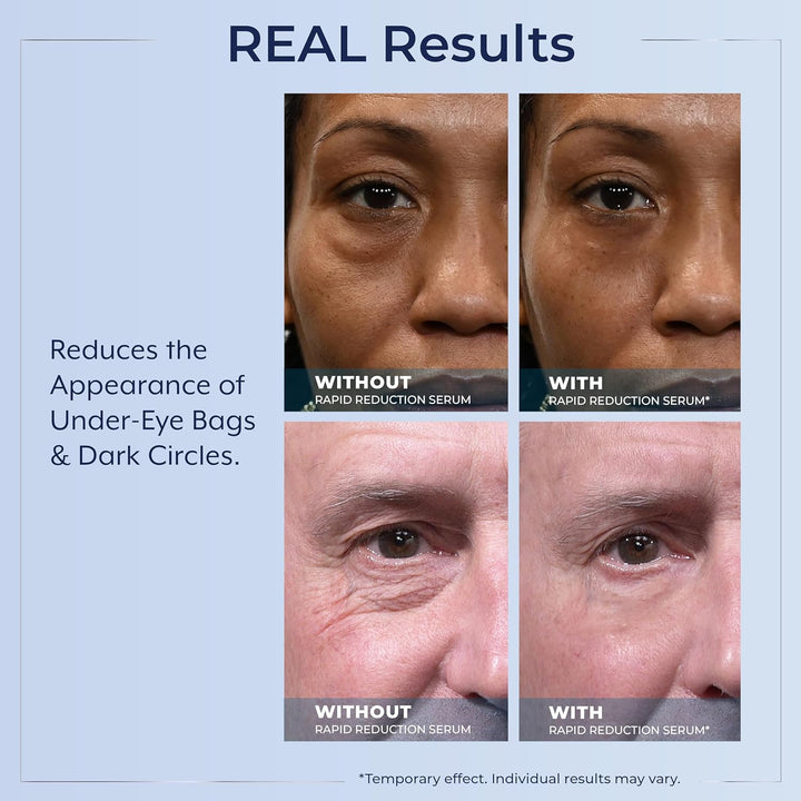 Rapid Reduction Eye Serum - Visibly Reduces Under-Eye Bags, Wrinkles, Dark Circles, Fine Lines & Crow'S Feet Instantly, anti Aging Wrinkle Remover for Face, Pump