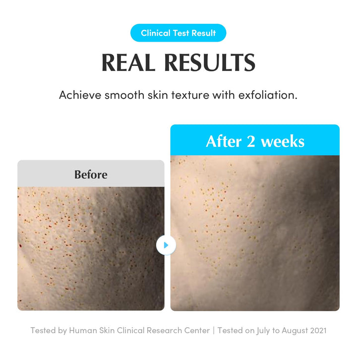 Swimming Pool Toner - Korean Toner for Daily Exfoliating & Deep Hydration with Natural Enzyme Protease & Hyaluronic Acid, for Sensitive Skin, 10.14 Fl Oz (300Ml)