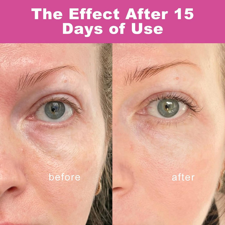 Vitaliq anti Wrinkle Calcium Balm, Stick,Wrinkle Core Stick with Calcium,Intensive Repair Moisturizing Cream,Suitable for Eyes,Neck, Face (2Pcs)