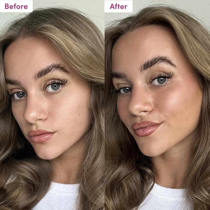 Sunny Honey Bronzing Face Tanning Drops (Medium Glow) for Natural Self Tanning Hydrating Hyaluronic Acid. Gradual Face Tanning Serum. Indoor Sunless Moisturizing Self Tanner (1 Fl Oz)