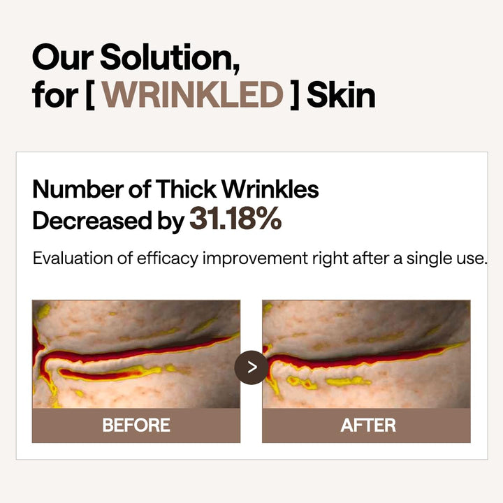 Retinol Collagen under Eye Patches - Korean Hydrogel Eye Pads (60 Patches) with 95% Retinol & 5 Micro Collagen. Nourishing & Non Irritating Eye Gel Mask. Sealing Cap & Spatula Included.