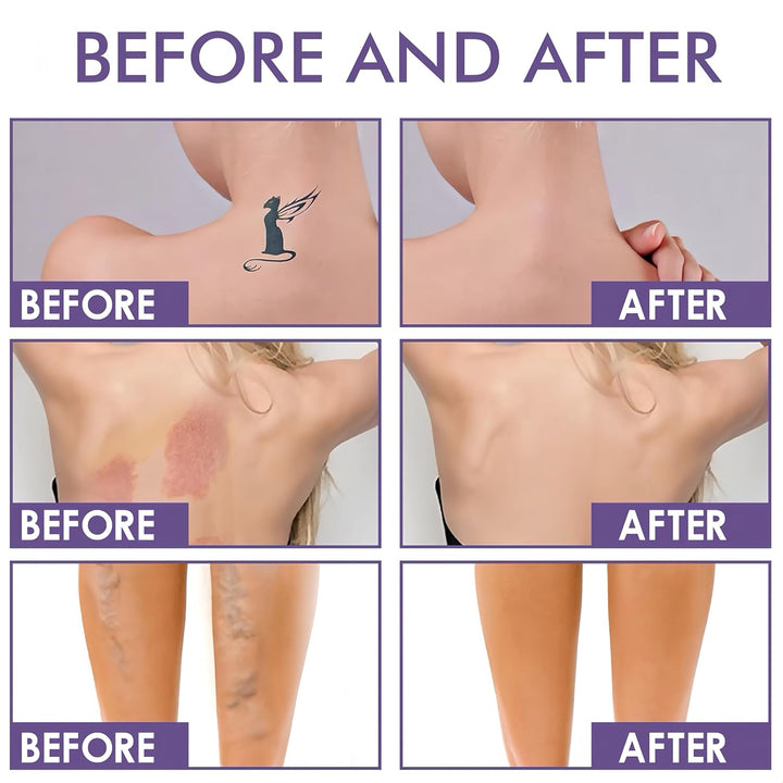 Waterproof Body Concealer for Legs and Body,Tattoo and Scar Cover Foundation,Natural Radiance, High Coverage, Transfer Resistant Body Makeup (Brush Included) 2.5Oz