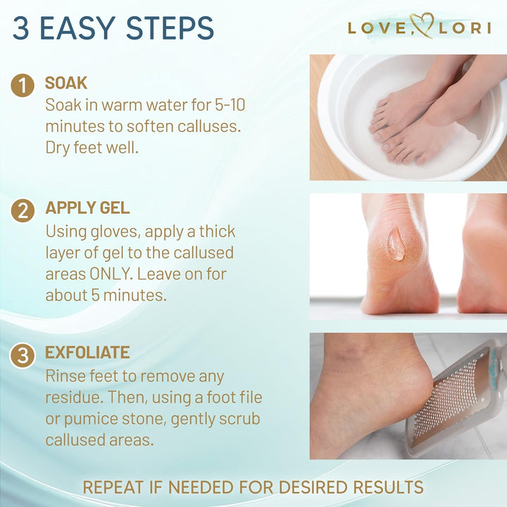Callus Remover for Feet (Extra Strength) Foot Callus Remover Gel - Feet Scrubber, Pedicure Spa Tools, 6Oz