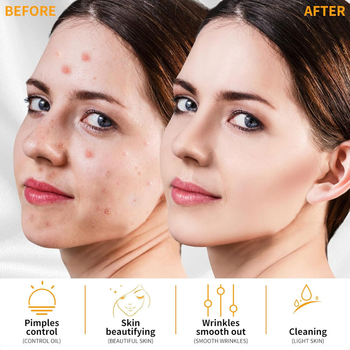 High F Rrequncy Portable Handheld Facial Skin Care Wand Machine