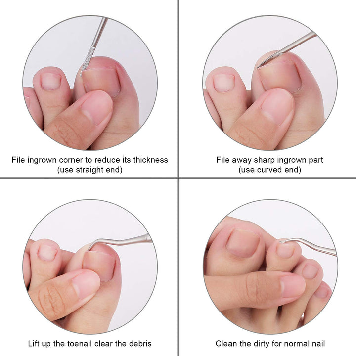 2PCS Ingrown Toenail File and Lifter with Storage Case,100% Stainless Steel Ingrown Toenail Tool,Double Sided Professional Grade Nail Cleaner Tool