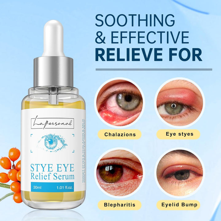 Stye Eye Treatment, Chalazion Remover, Eye Serum for Styes Chalazion and Blepharitis Treatment, with Avocado Oil, Sea Buckthorn Oil & Caffeine 1.01 Fl Oz/30 Ml