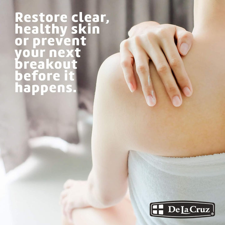 10% Sulfur Ointment - Cystic Acne Treatment for Face and Body - Daily 10 Min Spot Treatment Mask - Safe and Effective Game Changing Hormonal Acne Treatment That Clears up Pimples - 2.6 Oz