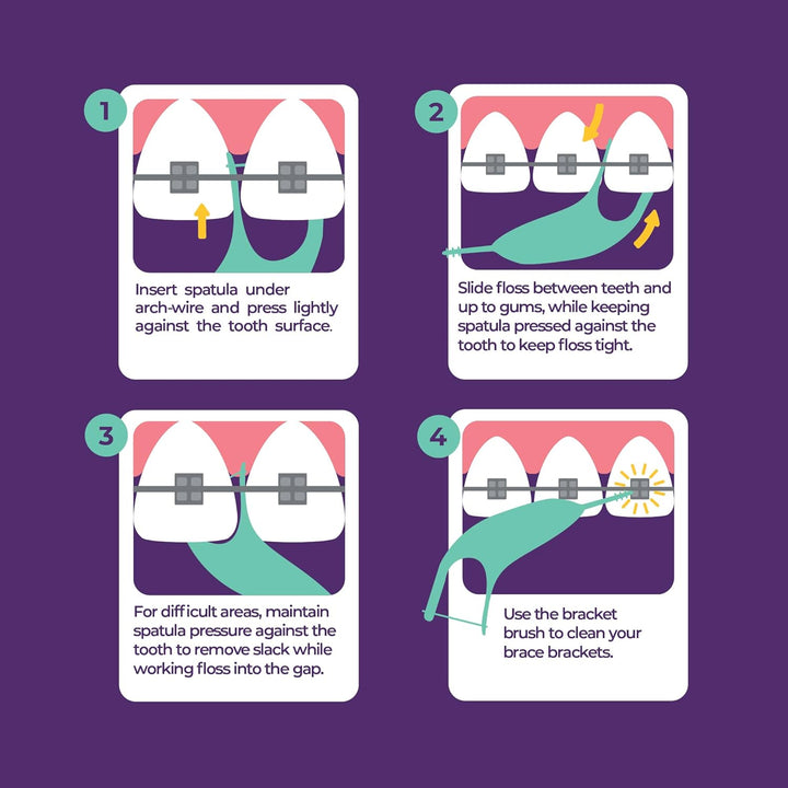 Orthodontic Flossers for Braces, 30 Count (Pack of 2), Ortho Picks for Adults & Kids, Fits under Arch Wire, Non-Damaging, Encourage Flossing Habits