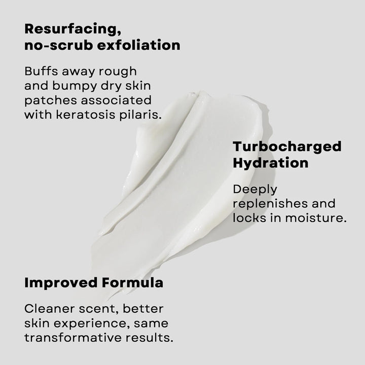 KP Bumps Be Gone - 3 Oz Keratosis Pilaris Moisturizing Cream with 15% Lactic Acid - Exfoliator and Moisturizer for Dry, Rough and Bumpy Skin (Packaging May Vary)