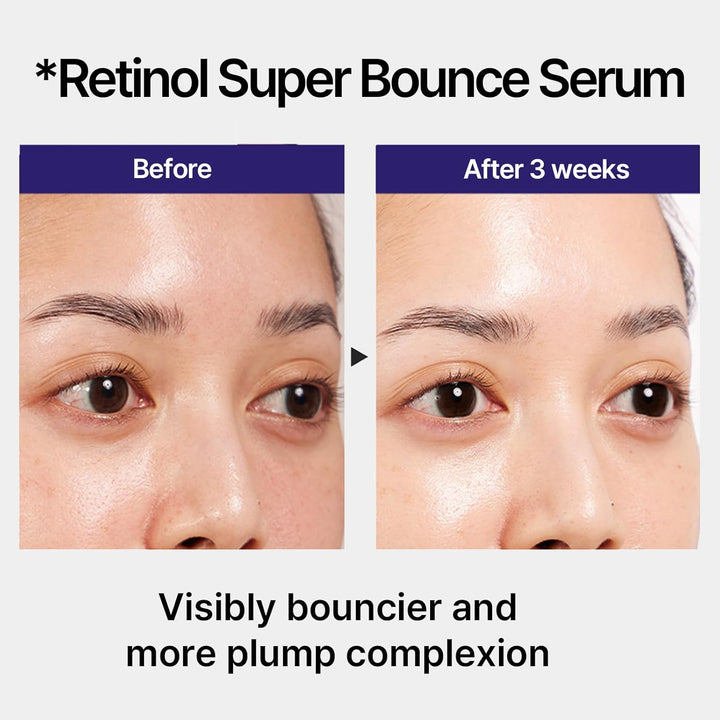 Retinol Super Bounce Serum | Korean Retinoid Eye Treatment for Anti-Aging, Beginner Friendly, Reduction in Fine Lines & Wrinkles, Firming and Rejuvenating, Daily Glow Routine, 1.01 Fl Oz.