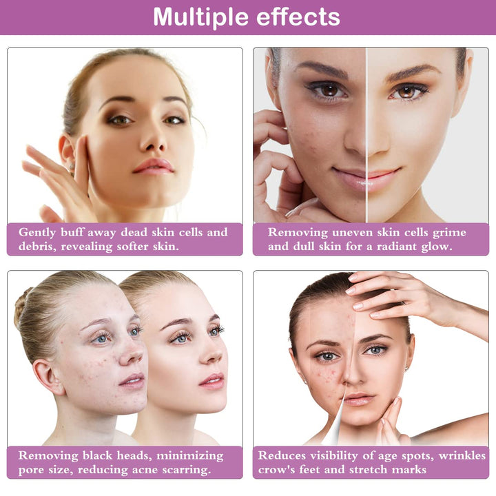 Diamond Microdermabrasion Machine,  65-68Cmhg Suction Power Professional Dermabrasion, Home Use Facial Skin Care Equipment