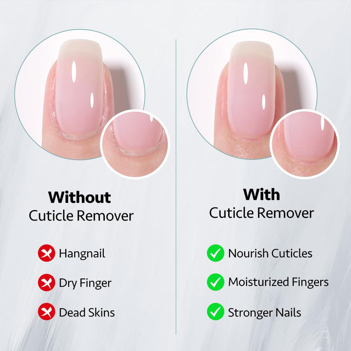20Ml Cuticle Remover Gel, Nail Care Softener, Easy and Effective Cuticle Remover