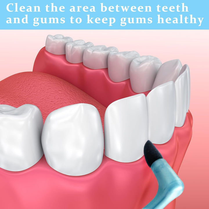 10 Pcs Gum Stimulator Dental Tools Dental Plaque Remover Rubber Tip Stimulator for Cleaning Teeth Tartar