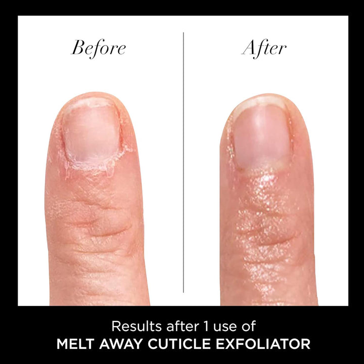 Cuticle Remover Liquid