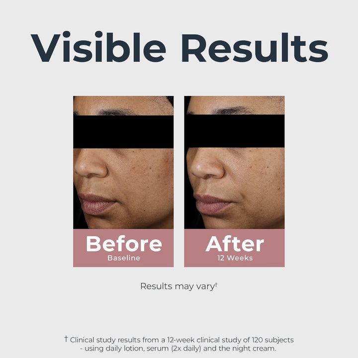 Radiant Tone Dual Serum Dark Spot Corrector, Dark Spot Serum with Thiamidol and Hyaluronic Acid, Helps Visibly Reduce the Look of Persistent Dark Spots, 1 Fl Oz Bottle