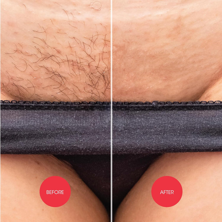 down under Cream for Women, Intimate Hair Removal Cream 150 Ml