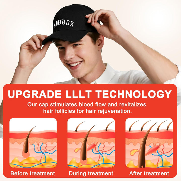 Laser Hair Growth Cap