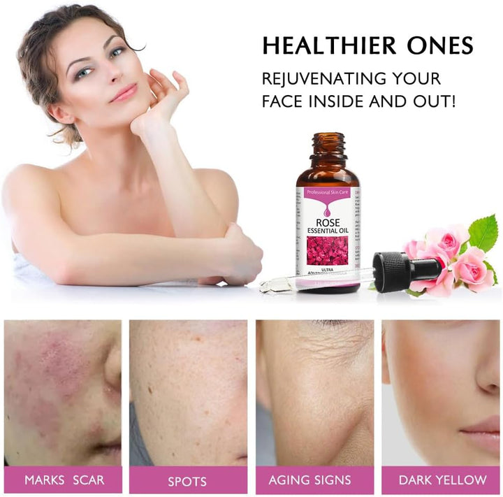 Rose Essential Oil, Face Moisturizer Oil, Face Essential Oils for Women, Rose Oil for Face, Skin Care, 1 FL.OZ (30Ml)