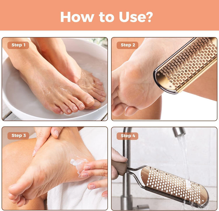 Foot File Foot Scrubber Pedicure - Callus Remover for Feet  Professional Grater Rasp Foot Scraper Corns Callous Removers Cracked Dead Skin Remover for Dry and Wet Feet (Golden)