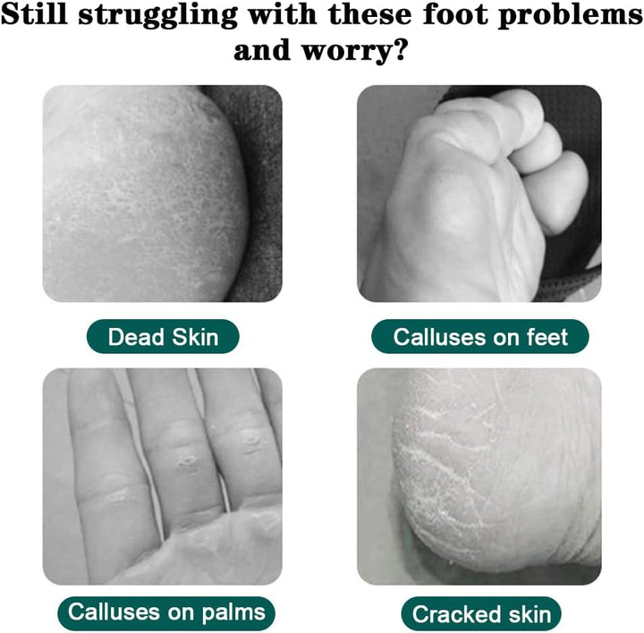 Professional Pedicure Foot Spa Set,10 in 1 Pedicure Set for Feet, Stainless Steel Foot Care Kit, Rasp Dead Skin Remover