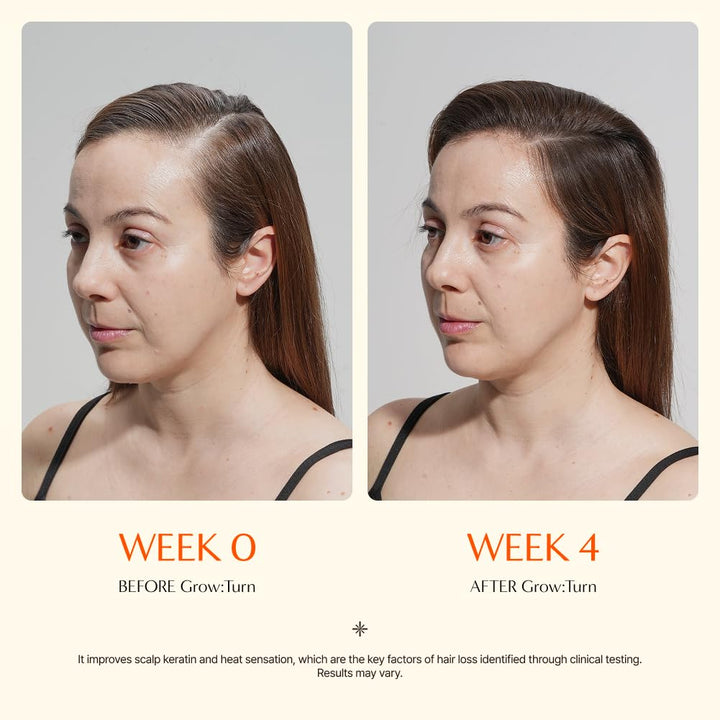 Growturn Hair Growth Serum with Built in Brush for Hair Growth & Thickening | Treatment for Thinning Hair, Hair Loss | Low Irritation, Fragrance-Free, Sulfate & Paraben-Free, 3.38 Fl. Oz. (Pack of 1)