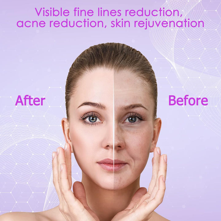 Phototherapy Device High Frequency Facial Wand Machine with Argon Tubes for Face Chin Neck Hair, Facial Skin Wand Machine with 4 Different Tubes