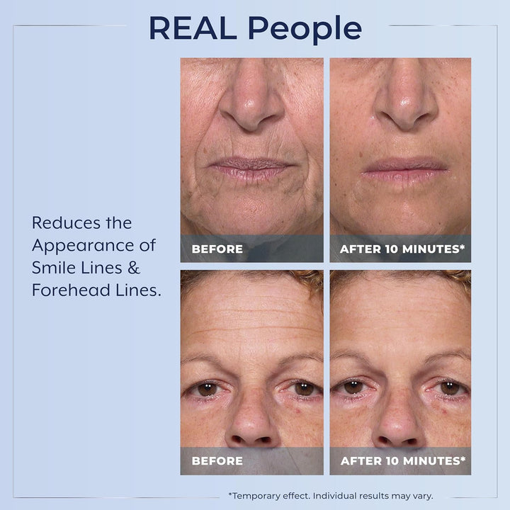 Rapid Reduction Eye Serum - Visibly Reduces Under-Eye Bags, Wrinkles, Dark Circles, Fine Lines & Crow'S Feet Instantly, anti Aging Wrinkle Remover for Face, Pump