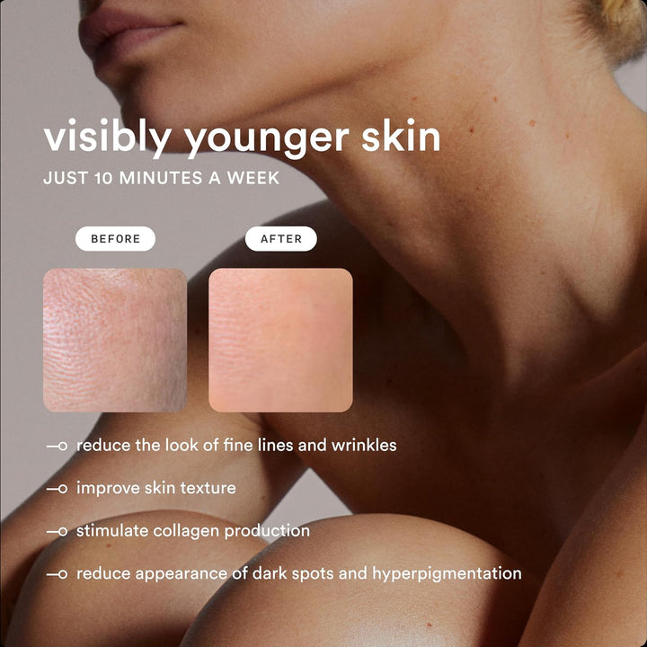 NEW ™ Flasher Pro — IPL Laser Hair Removal Device for Women & Men with Sapphire Cooling — Pain-Free & Permanent, Visible Results after First Use & Works Everywhere Hair Grows — Gloss White