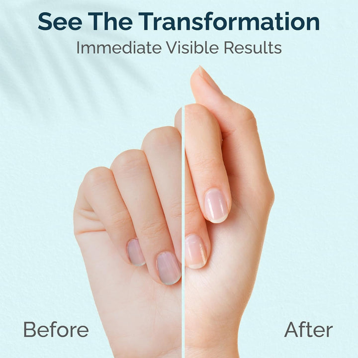 Cuticle & Nail Cream Treament, Deep Nourishing - USA Made - Daily Repair Nail Care W/Organic Shea Butter, Jojoba Oil - Soften Cuticles, Strengthen Nails, Hydrating (1 Fl Oz/Pack of 1)