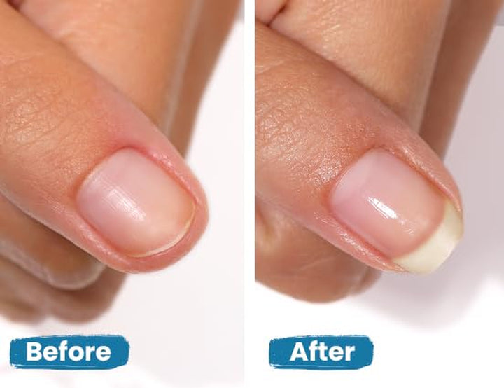 Get Strong Nail Hardener - Nail Strengthener Growth Treatment for Damaged Nails, Conditioning Nail Care for Long Healthy Nails, .40Fl Oz