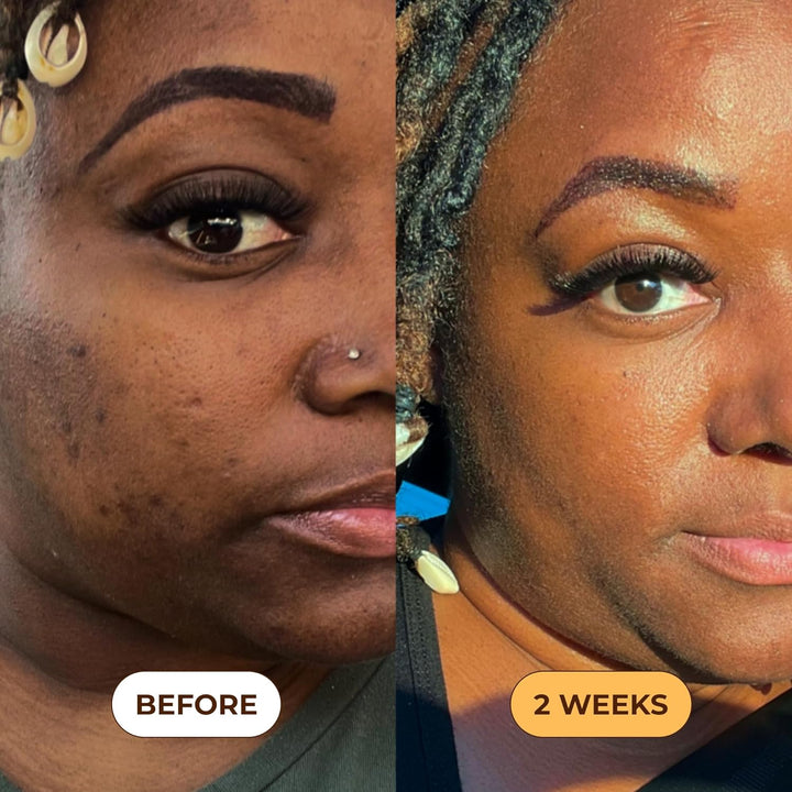 Turmeric Scrub for Dark Spots, Brightening Inner Thighs Bikini Area Underarms, Natural Exfoliating Face