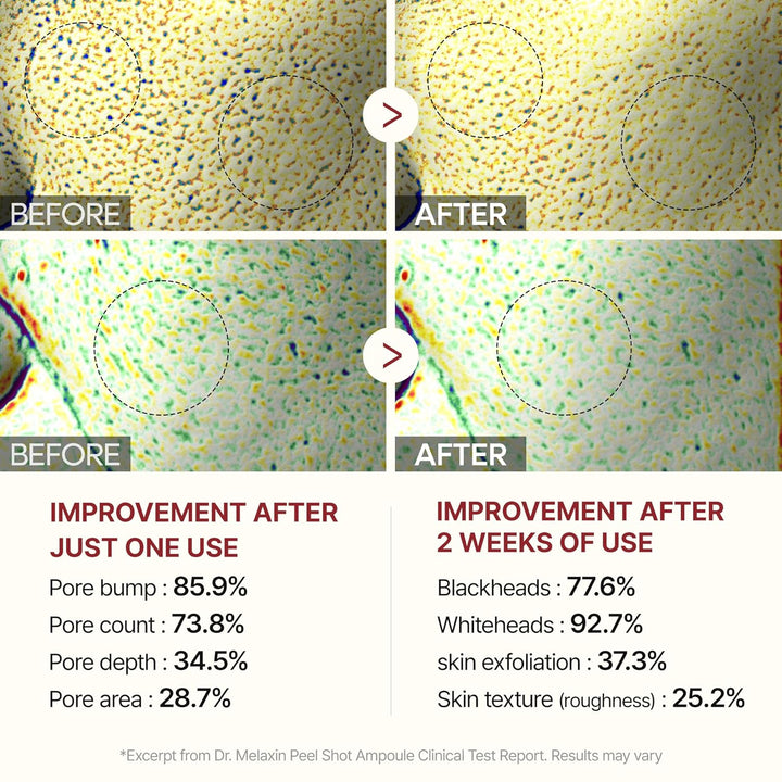 Peel Shot Glow Black Rice Peeling Ampoule 80Ml Daily Soft Exfoliating Face and Body Scrub Dead Skin Cells Remover for All Skin Types Korean Skin Care