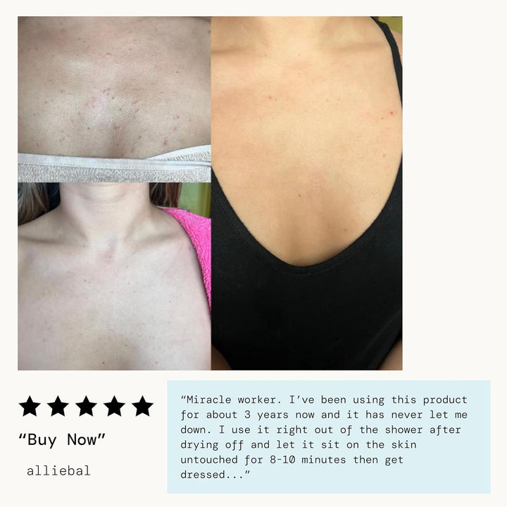 Bacne Warrior - Bacne Salicylic Acid Spray, Back Acne Treatment Spray with 2% Salicylic Acid, Niacinamide, and Aloe, Body Acne Warrior for Body, Chest, and Back, Dermatologist Tested- 6 Fl Oz