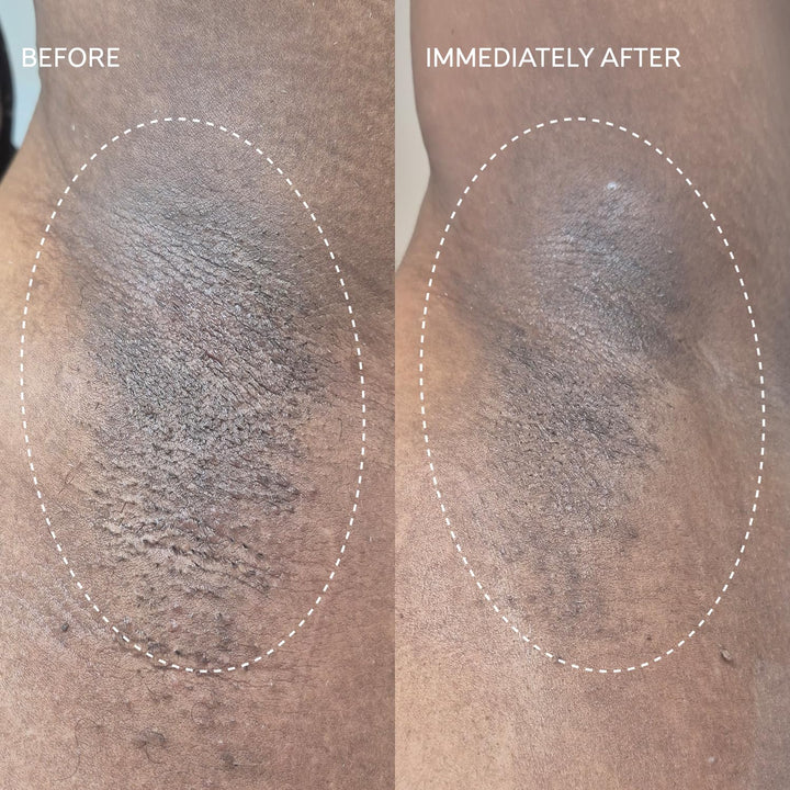 Flash Repair Jelly – Hypochlorous Acid Aftercare Gel for Post-Wax, Shave, or Laser – Soothes Redness, Bumps, and Irritation Dermatologist-Tested, Fragrance-Free (2.0 Fl Oz / 60Ml)