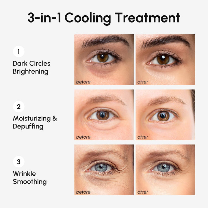 Eye Gels - Pads under Eye Patches for Puffy Eyes and Dark Circles with Collagen & Hyaluronic Acid - anti Wrinkles under Eye Masks Skincare Treatment for Puffiness & Bags - Parches Para Ojeras