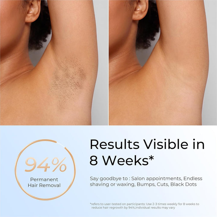 Laser Hair Removal, IPL Laser Hair Removal for Women and Men Permanent, Hair Removal Device with 3.0 IPL Red Light Wave, Home Laser Hair Removal Device for Facial Legs Armpits Bikini Body Use