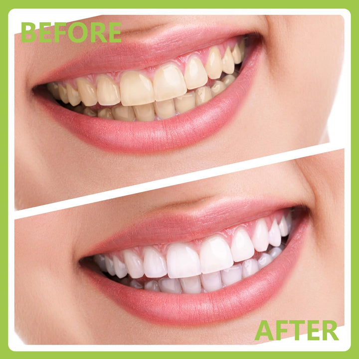 Dental Tools, Professional Teeth Cleaning Oral Care Hygiene Kit, Stainless Steel Dental Pick Tooth Scraper Tartar Plaque Remover for Dentist, Personal, Pet Use with Storage Box