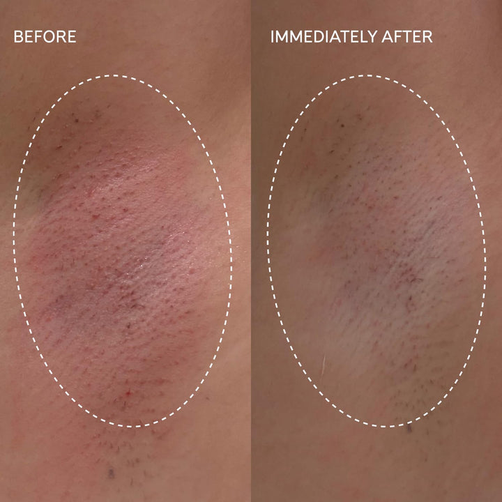 Flash Repair Jelly – Hypochlorous Acid Aftercare Gel for Post-Wax, Shave, or Laser – Soothes Redness, Bumps, and Irritation Dermatologist-Tested, Fragrance-Free (2.0 Fl Oz / 60Ml)