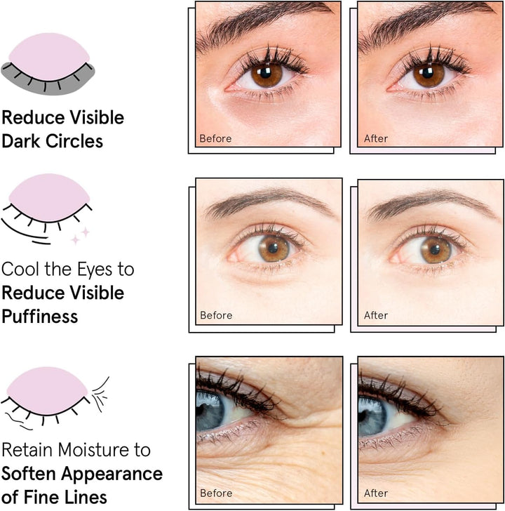 Award Winning under Eye Mask - Travel Essentials - Birthday Gifts for Women - Gel Eye Patches for Dark Circles, Puffy Eyes, Wrinkles, Undereye Bags - Vegan Self Care (48 Pairs, Gold)