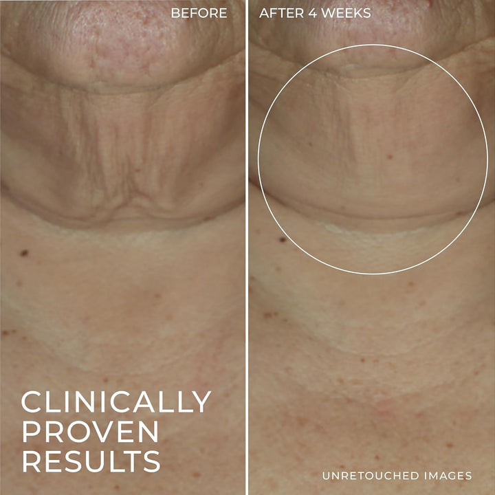 Derm Correxion Retinol Firming Serum Stick with Antioxidants to Visibly Tighten and Firm Wrinkles and Laugh Lines 1.0 Oz plus Retinol Eye Cream Packette