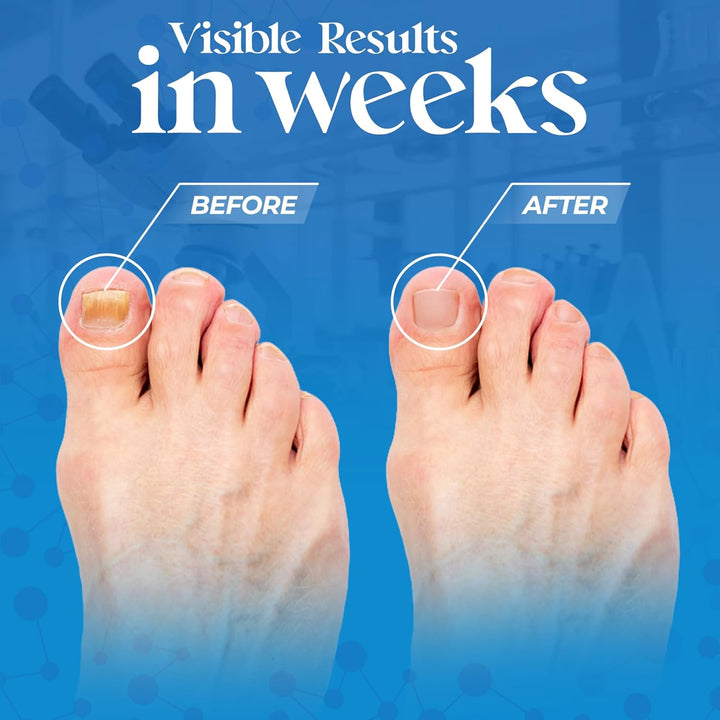 Tea Tree Foot Soak with Magnesium Flakes and Dead Sea Foot Soaking Salts - Pedicure Tea Tree Oil Foot Soak for Dry Cracked Feet-Athlete'S Callus Remover- Eliminates Odor- Packaging May Vary