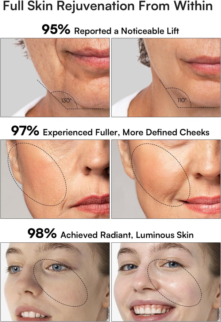 3-In-1 Red Light Therapy for Face and Neck Beauty Device for Puffiness & Skin Firming Skincare Tool (Black)