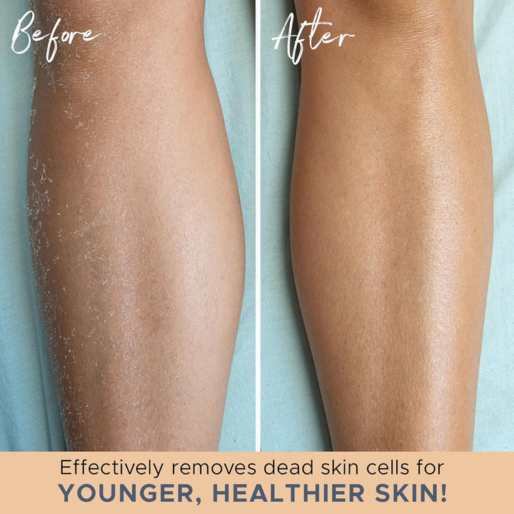 Exfoliating Glove (4 Pcs, 2 Pairs) - Heavy Shower Gloves for Body Scrub, Exfoliates & Removes Dead Skin