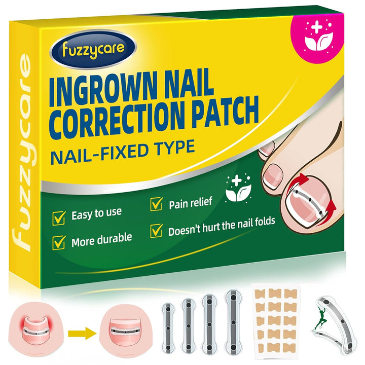 Large Size-Titanium Alloy Ingrown Toenail Treatment & Removal Kit for Quick Relief, Ingrown Toenail Removal Kit， Professional Ingrown Toenail Corrector, Ingrown Toenail Tools for Quick Relief, 10 Pcs