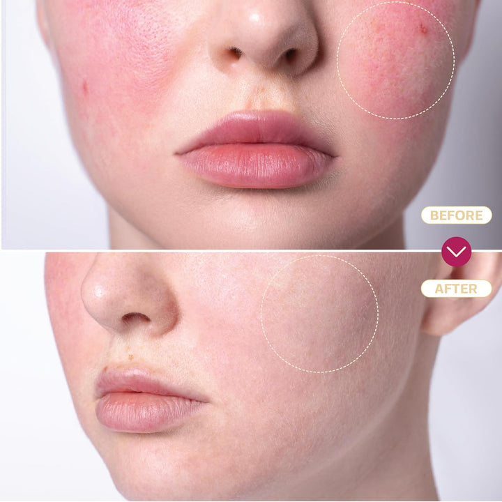 Hypochlorous Acid Spray for Face & Skin | 8 Oz | Facial Spray Daily Skin Repair Solution for Sensitive Skin, Redness, Irritations, Eczema, Acne. Hypochlrous HOCL Molecule Spray