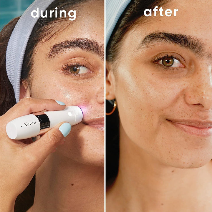 Mini Facial Hair Remover for Women'S Face, Portable Electric Shaver/Razor, Hair Removal for Women, Dermaplaning Tool, Trimmer